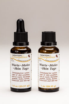 Warts~Moles~Skin Tags